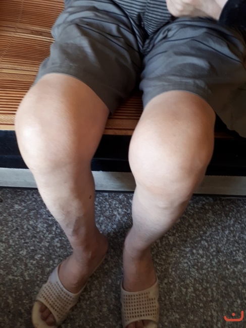 Người bệnh chữa khỏi _1