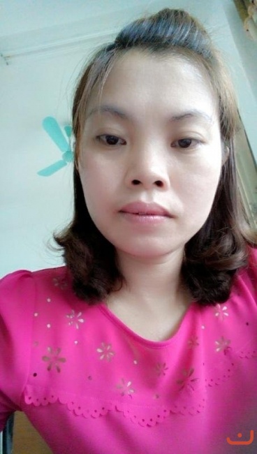 Chị Bùi Thị Thuỷ 36 tuỏi ở Thành Phố Điện Biên - Tỉnh Điện Biên Bị bệnh Pemphigus được đi khám xét nghiệm chuẩn đoán chính sác, đến bốc thuốc chữa khỏi 2 năm nay và từ đó đến nay không cần uống thêm thuốc gị