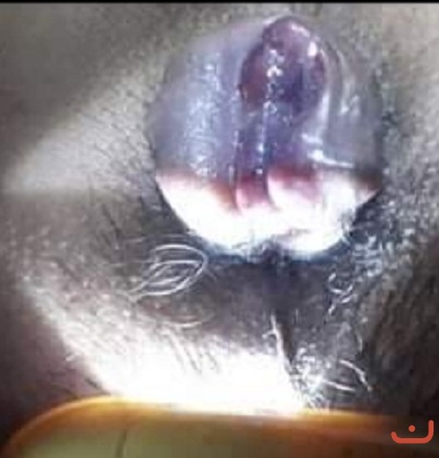 Bệnh trí nội, trí ngoại_1