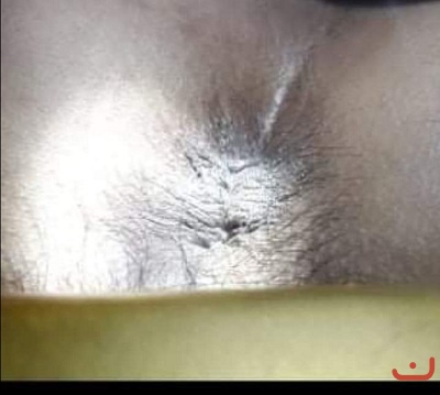 Bệnh trí nội, trí ngoại_2